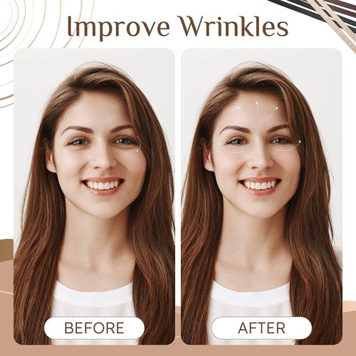 Facelift Bands With Clips 3pcs